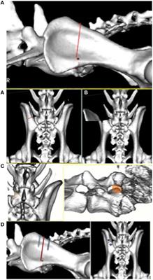 Commentary: Complete Cranial Iliac Osteotomy to Approach the Lumbosacral Foramen